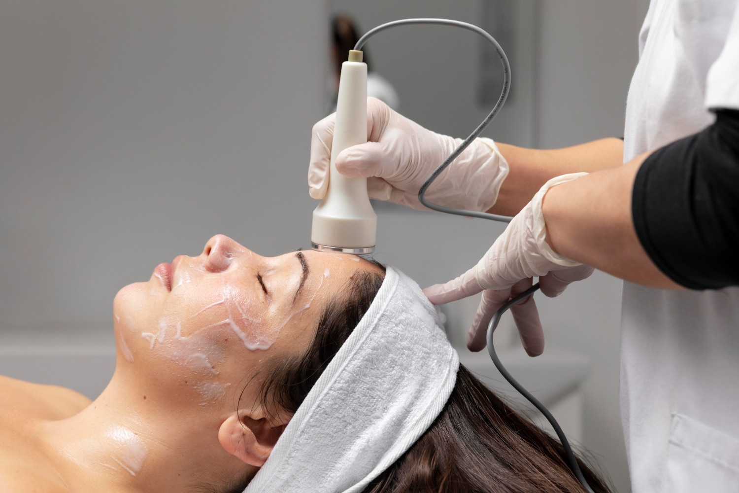 Anasa Aesthetics | Collagen induction treatments