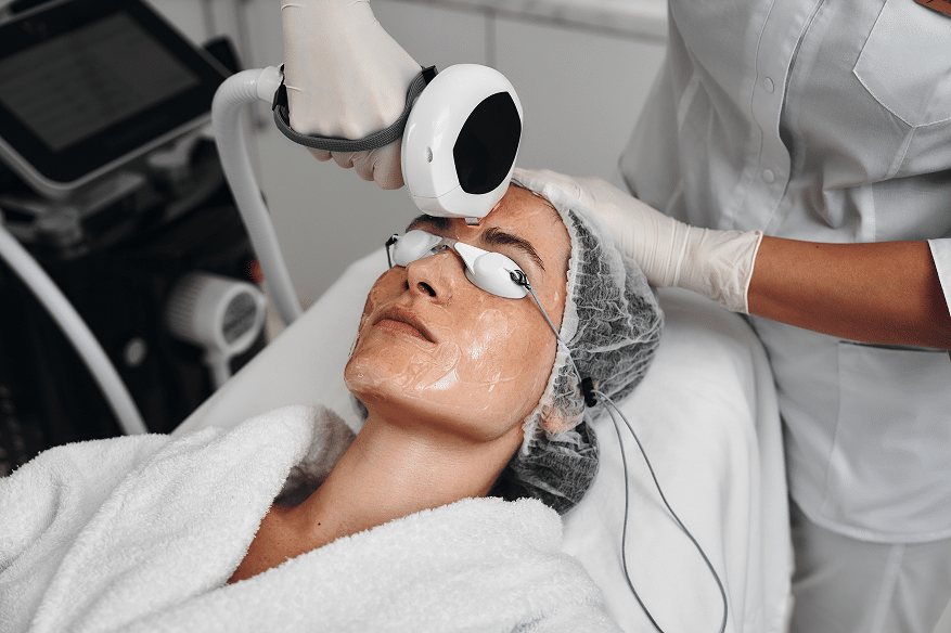 Anasa Aesthetics | Icon Photofacial IPL in Boca Raton