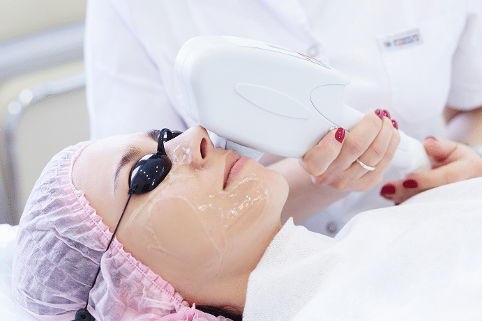 Anasa Aesthetics | Icon Photofacial IPL in Boca Raton