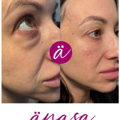 505734821_18395570188117997_8143267082102628638_n