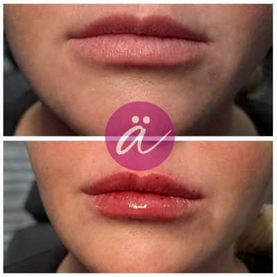 519311843_18400130128117997_3974644646522411768_n