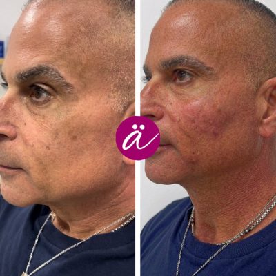 545284916_18407920852117997_3350518704457285367_n